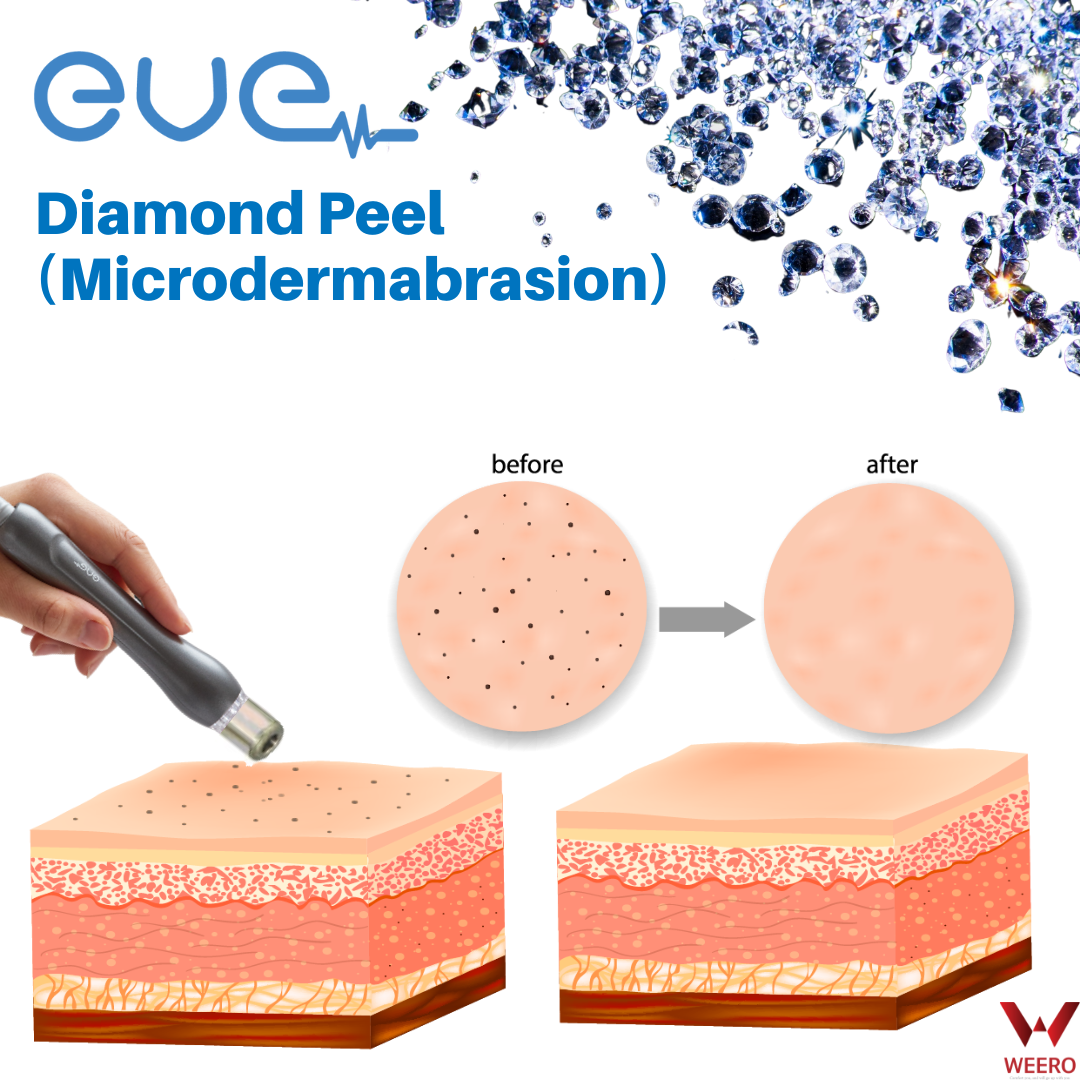 EVE Ace of Face Diamond Peeling Microdermabrasion 썸네일
