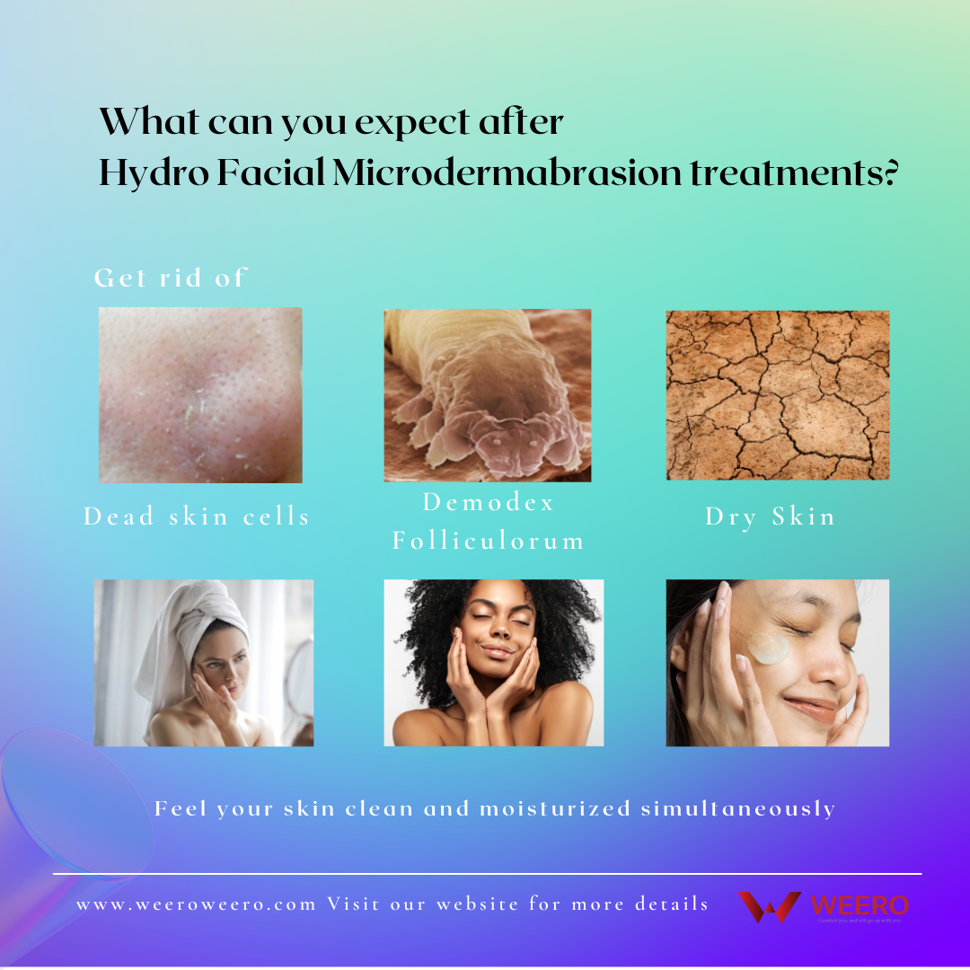 Hydro Facial Microdermabrasion.png